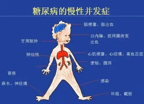 五个方向，看干细胞如何攻克老年糖尿病