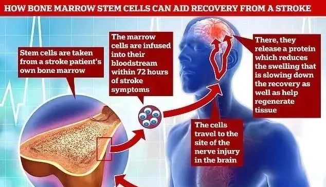 治愈八大系统疾病，干细胞全搞定