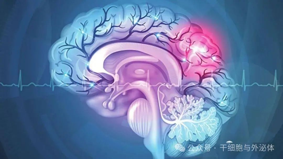 592名患者，13项临床研究证实：干细胞可降低缺血性中风的死亡率