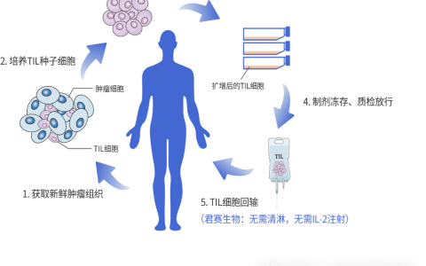 370万天价细胞疗法！中国首款TIL细胞疗法来了，启动临床招募！