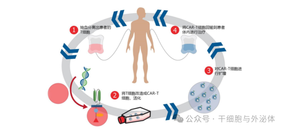 浙大一院：我国原研细胞疗法为急淋白血病患者提供“治愈”新解