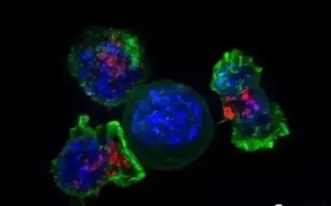 衰退的免疫系统才是致癌的主因，回输免疫细胞是最好的补救办法