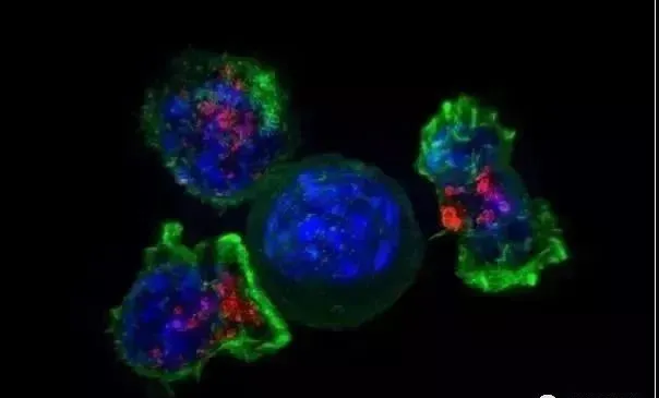 衰退的免疫系统才是致癌的主因，回输免疫细胞是最好的补救办法
