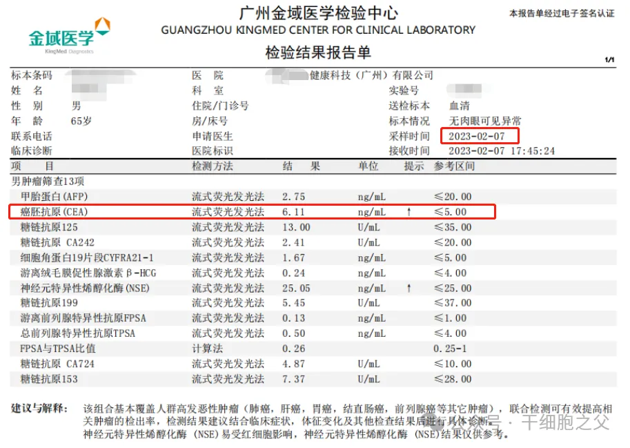 回输300亿免疫细胞后，显著降低了肿瘤标志物CEA水平