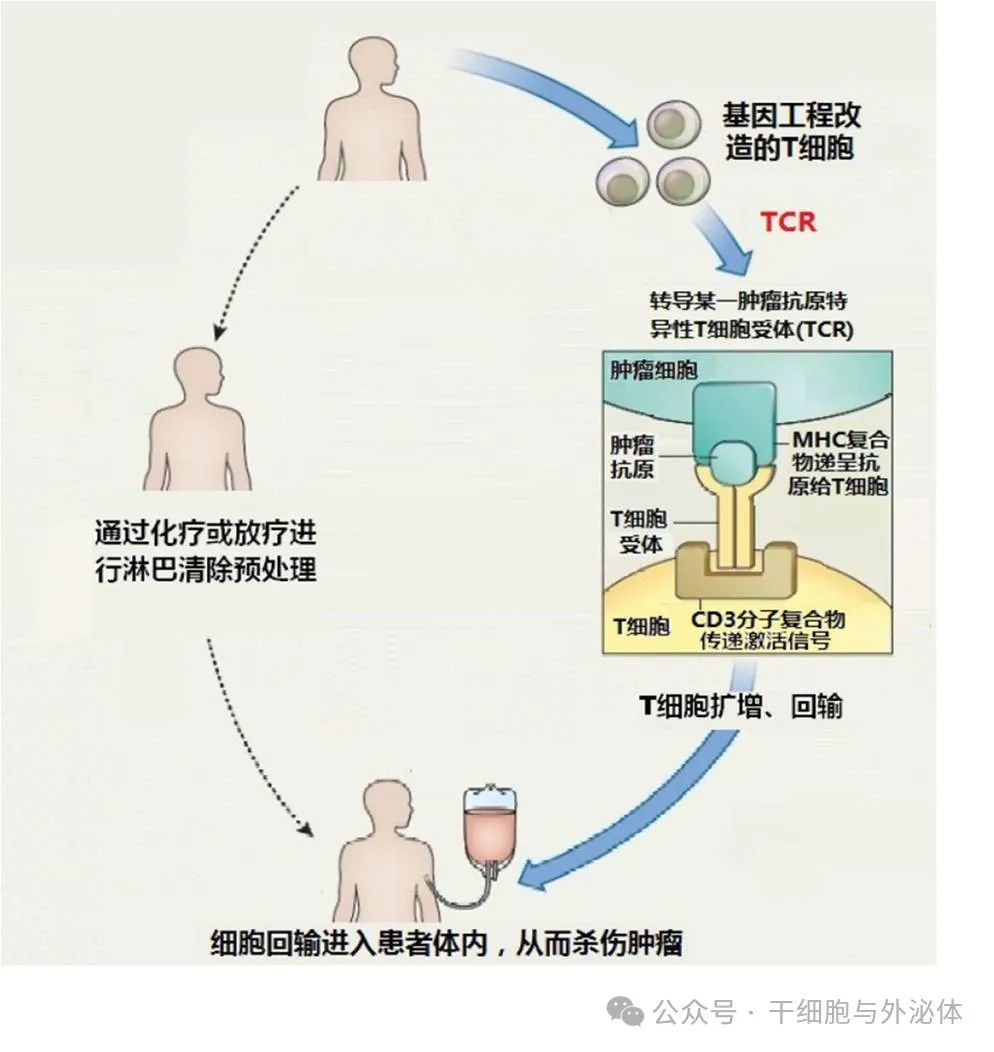 新型免疫细胞疗法让52名患者肿瘤缩小或完全消失