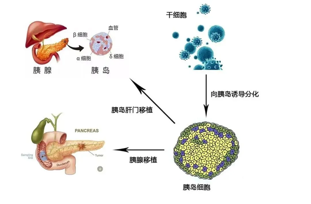 案例证实丨未来干细胞的使用范围和适应症