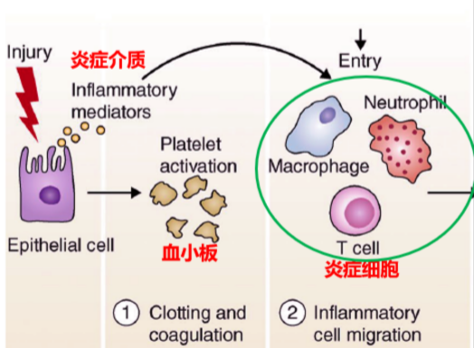 干细胞在肺纤维化的临床应用