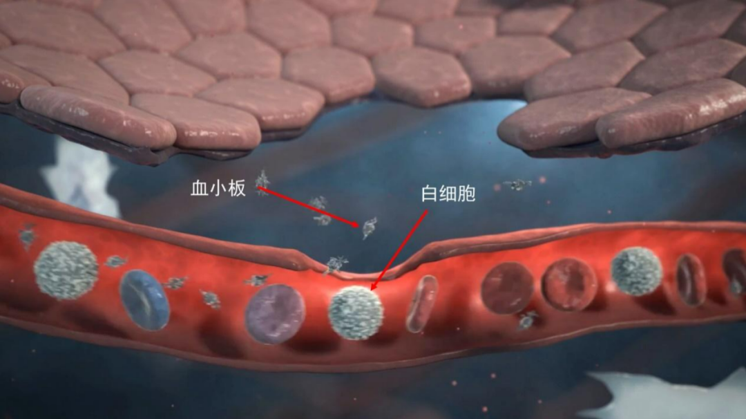 干细胞在肺纤维化的临床应用