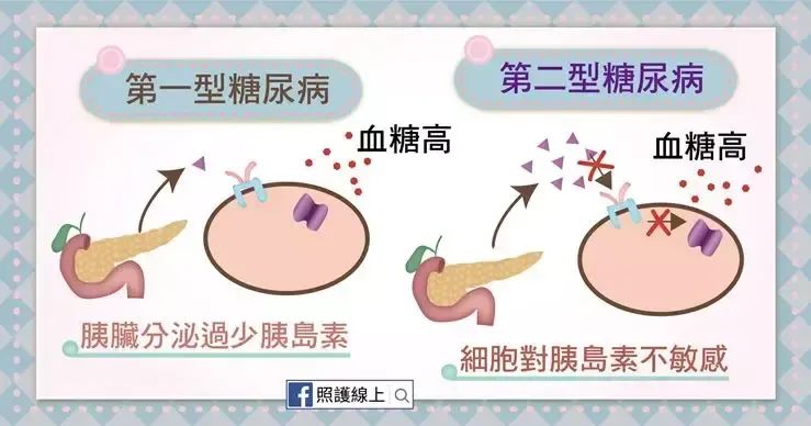 糖尿病治疗新突破！我国自研干细胞疗法获批临床研究，直击胰岛β细胞修复，开启源头治疗新篇章！