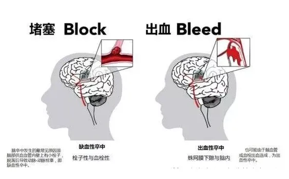 案例证实丨未来干细胞的使用范围和适应症