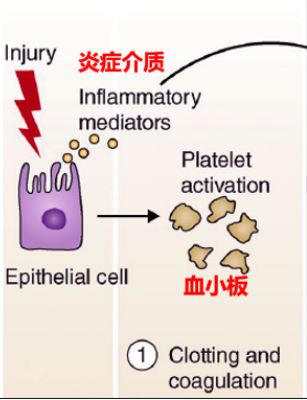 干细胞在肺纤维化的临床应用