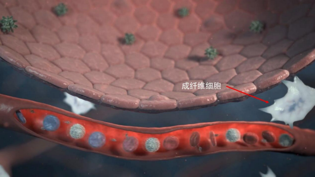 干细胞在肺纤维化的临床应用