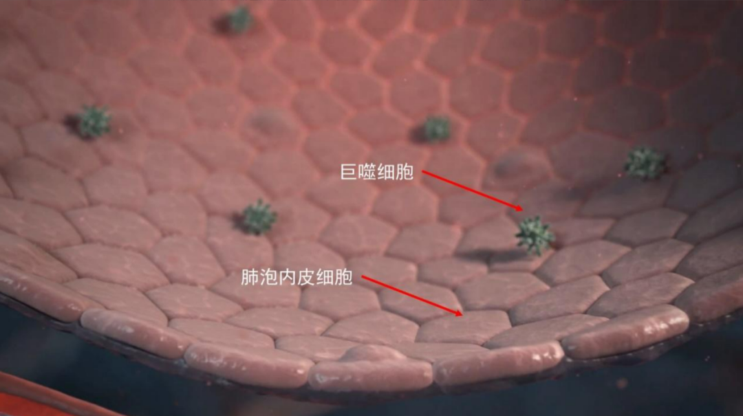干细胞在肺纤维化的临床应用