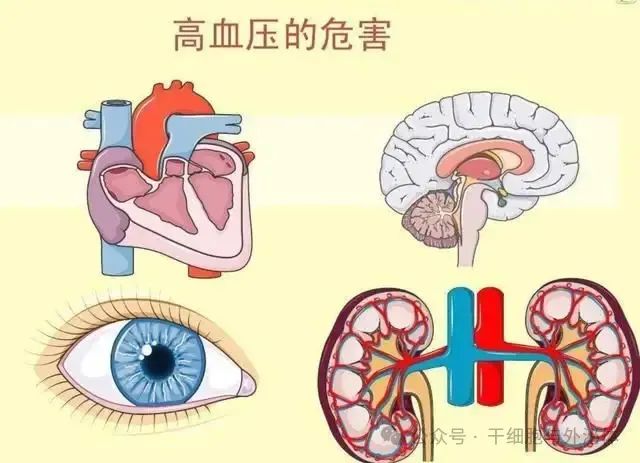 高血压脑出血40例：间充质干细胞治疗改善患者语言、肌张力、肌力功能