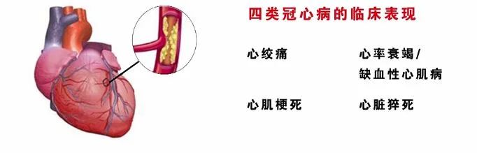 真实案例：央视报道干细胞治疗多例心脏病患者，症状明显改善