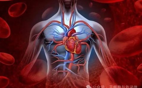 高血压脑出血40例：间充质干细胞治疗改善患者语言、肌张力、肌力功能