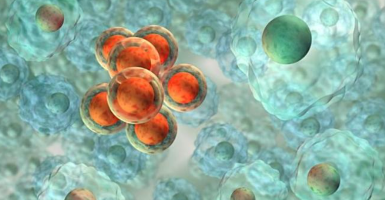 干细胞注射液：治疗5年死亡率超50%的心衰患者进入临床试验