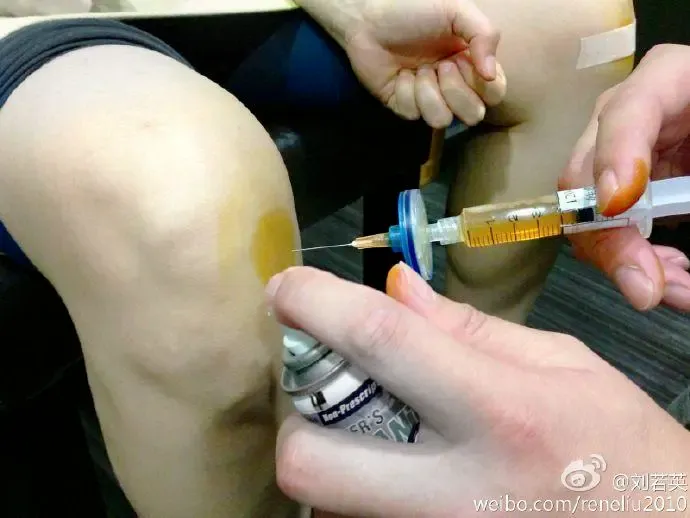 5年随访证实：干细胞治疗慢性膝关节疼痛安全有效