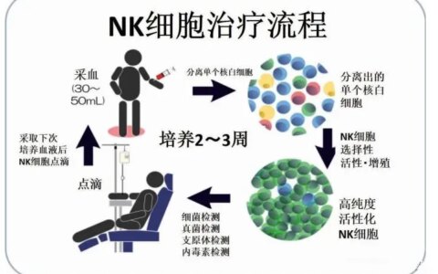 回输60亿NK细胞后，身体会有哪些惊人的变化？