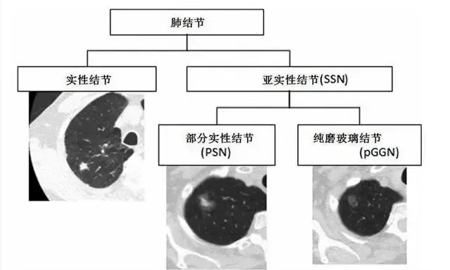 为什么接受细胞治疗前一定要体检?
