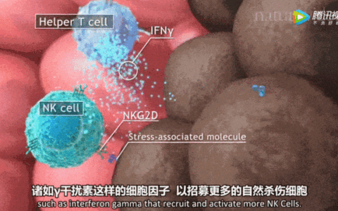 案例：17次NK细胞回输，晚期肝癌患者如何改写“生命终章”？