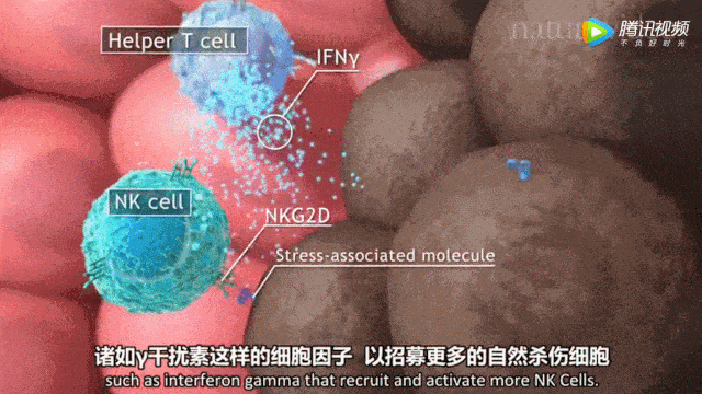 案例：17次NK细胞回输，晚期肝癌患者如何改写“生命终章”？
