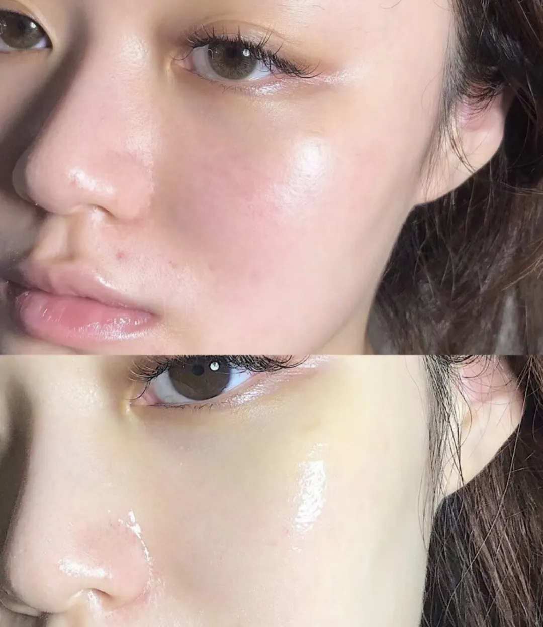 水光针VS外泌体:诺贝尔奖加持的“外泌体”为何能在医美界火爆出圈?